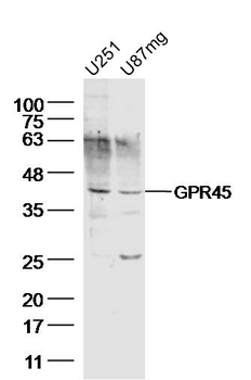 GPR45 Rabbit Polyclonal Antibody