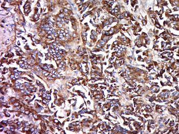 GPR52 Rabbit Polyclonal Antibody