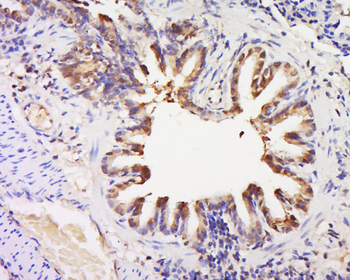 GPR92 Rabbit Polyclonal Antibody