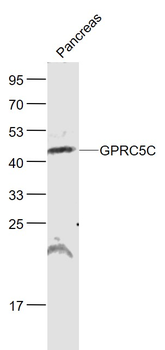 GPRC5C Rabbit Polyclonal Antibody