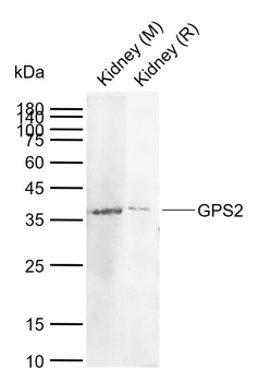GPS2 Rabbit Polyclonal Antibody