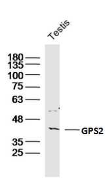GPS2 Rabbit Polyclonal Antibody