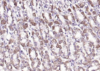GPX2 Rabbit Polyclonal Antibody