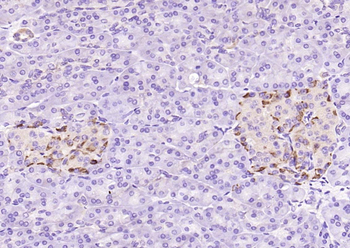 GSK3 Alpha + Beta Rabbit Polyclonal Antibody