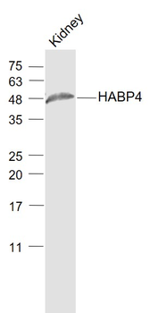 HABP4 Rabbit Polyclonal Antibody