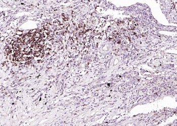 CD20 Mouse mAb