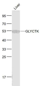 GLYCTK Rabbit Polyclonal Antibody