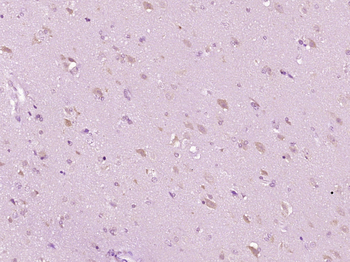 HBQ1 Rabbit Polyclonal Antibody
