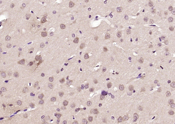 HBS1L Rabbit Polyclonal Antibody