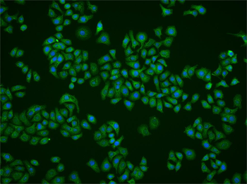 HCP1 Rabbit Polyclonal Antibody