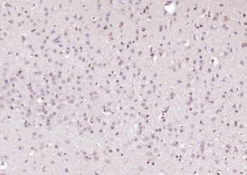 HDAC3 Rabbit Polyclonal Antibody