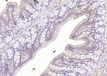 HDAC3 Rabbit Polyclonal Antibody