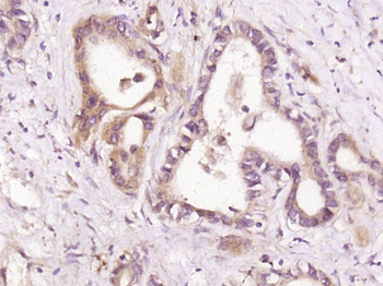 HDPTP Rabbit Polyclonal Antibody