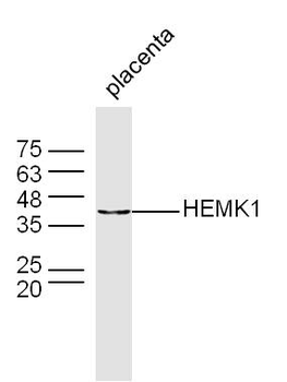 HEMK1 Rabbit Polyclonal Antibody