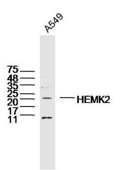 HEMK2 Rabbit Polyclonal Antibody