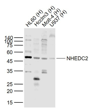 NHEDC2 Rabbit Polyclonal Antibody