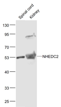 NHEDC2 Rabbit Polyclonal Antibody
