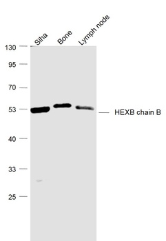 HEXB chain B antibody