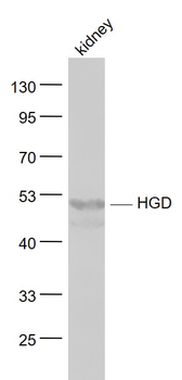 HGD Rabbit Polyclonal Antibody