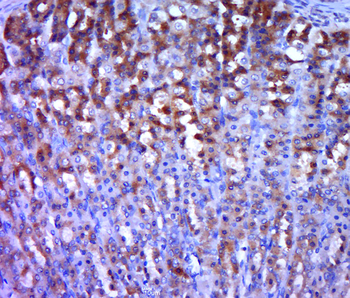 HGS Rabbit Polyclonal Antibody