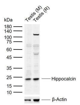 Hippocalcin Rabbit Polyclonal Antibody
