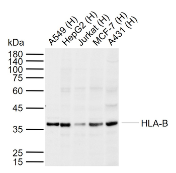 HLA-B Rabbit Polyclonal Antibody