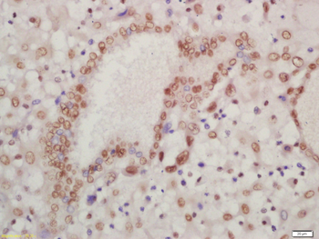 HOXA13 Rabbit Polyclonal Antibody