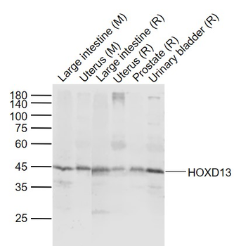 HOXD13 Rabbit Polyclonal Antibody