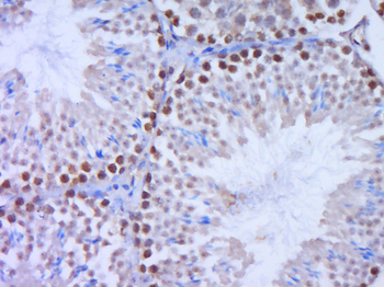 DNAJA1 Rabbit Polyclonal Antibody