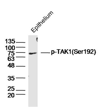 Phospho-HSP70 (Tyr41) Rabbit Polyclonal Antibody