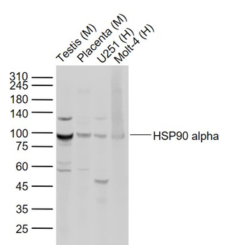 HSP90 alpha Rabbit Polyclonal Antibody
