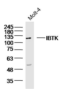 IBTK Rabbit Polyclonal Antibody