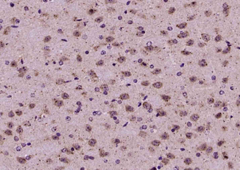 ICK Rabbit Polyclonal Antibody