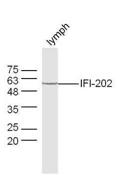 IFI202 Rabbit Polyclonal Antibody