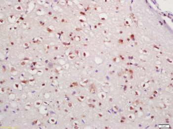 IFI202 Rabbit Polyclonal Antibody