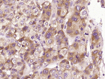 IFIT1 Rabbit Polyclonal Antibody