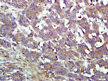 IFIT1B Rabbit Polyclonal Antibody