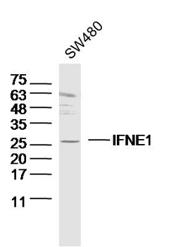 IFNE1 Rabbit Polyclonal Antibody