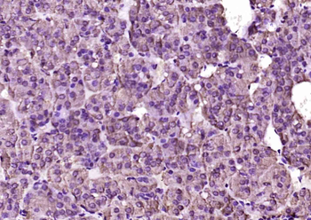 IFT140 Rabbit Polyclonal Antibody