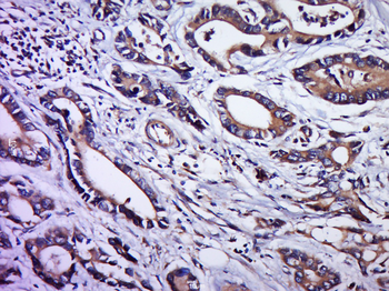 IGFL2 Rabbit Polyclonal Antibody