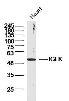 IGLK Rabbit Polyclonal Antibody