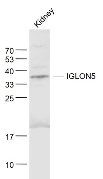 IGLON5 Rabbit Polyclonal Antibody