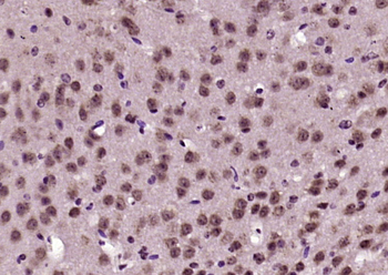 IKAP Rabbit Polyclonal Antibody