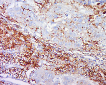 IL18 Rabbit Polyclonal Antibody