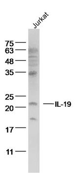 IL-19 Rabbit Polyclonal Antibody