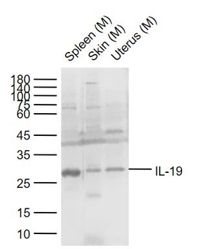 IL-19 Rabbit Polyclonal Antibody