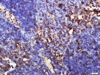 Inversin Rabbit Polyclonal Antibody
