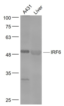 IRF6 Rabbit Polyclonal Antibody