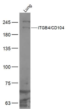 ITGB4/CD104 Rabbit Polyclonal Antibody
