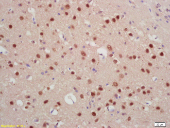 Jarid2 Rabbit Polyclonal Antibody